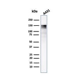 Western Blot - Anti-EGFR Antibody [GFR/2341] (A248393) - Antibodies.com