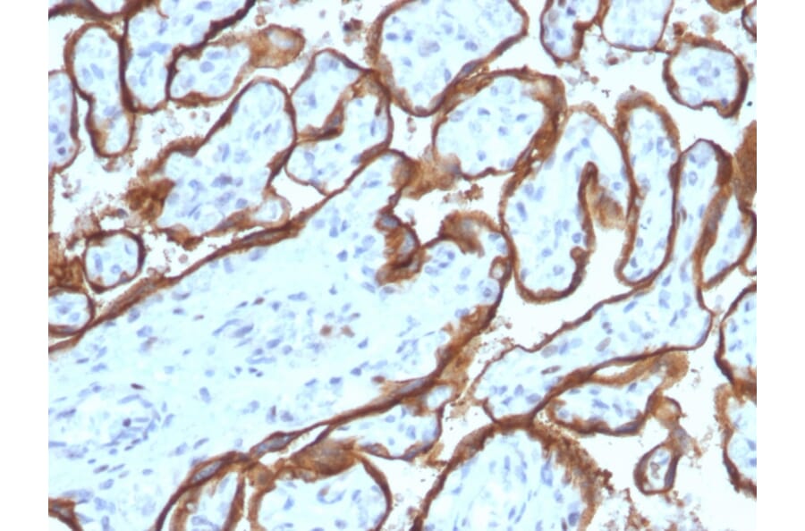 Immunohistochemistry - Anti-EGFR Antibody [SPM341] (A248393) - Antibodies.com