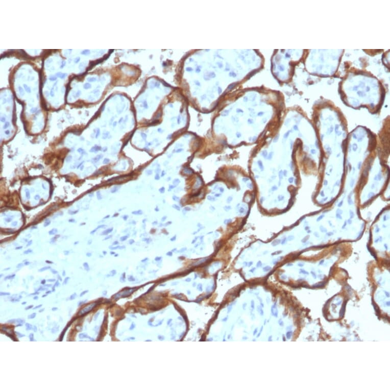 Immunohistochemistry - Anti-EGFR Antibody [SPM341] (A248393) - Antibodies.com