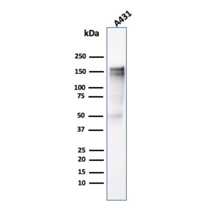Western Blot - Anti-EGFR Antibody [SPM341] (A248394) - Antibodies.com