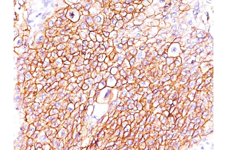 Immunohistochemistry - Anti-EGFR Antibody [GFR/2596] (A248395) - Antibodies.com