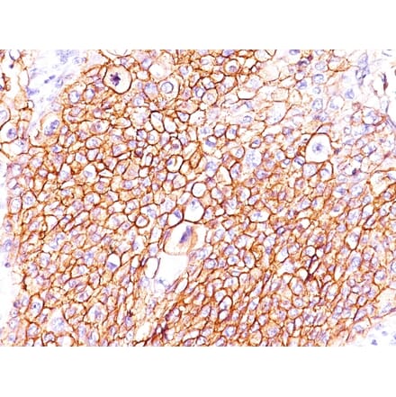 Immunohistochemistry - Anti-EGFR Antibody [GFR/2596] (A248395) - Antibodies.com