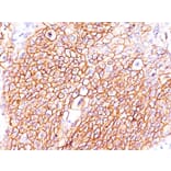 Immunohistochemistry - Anti-EGFR Antibody [GFR/2596] (A248395) - Antibodies.com