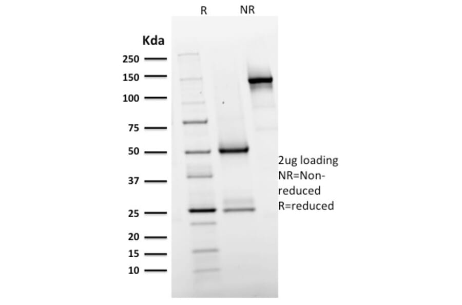 SDS-PAGE - Anti-EGFR Antibody [GFR/2596] (A248395) - Antibodies.com