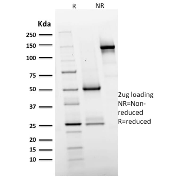 SDS-PAGE - Anti-EGFR Antibody [GFR/2596] (A248395) - Antibodies.com