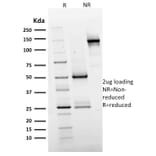 SDS-PAGE - Anti-EGFR Antibody [GFR/2596] (A248395) - Antibodies.com