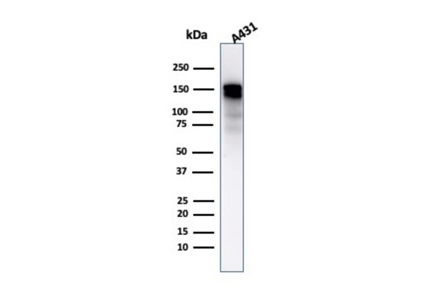Western Blot - Anti-EGFR Antibody [GFR/2596] (A248395) - Antibodies.com