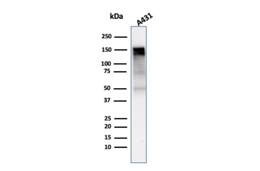 Western Blot - Anti-EGFR Antibody [rGFR/1667] (A248397) - Antibodies.com