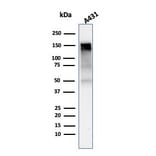 Western Blot - Anti-EGFR Antibody [rGFR/1667] (A248397) - Antibodies.com