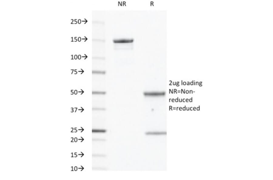 SDS-PAGE - Anti-EGFR Antibody [GFR450] (A248398) - Antibodies.com
