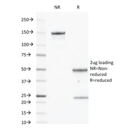 SDS-PAGE - Anti-EGFR Antibody [GFR450] (A248398) - Antibodies.com