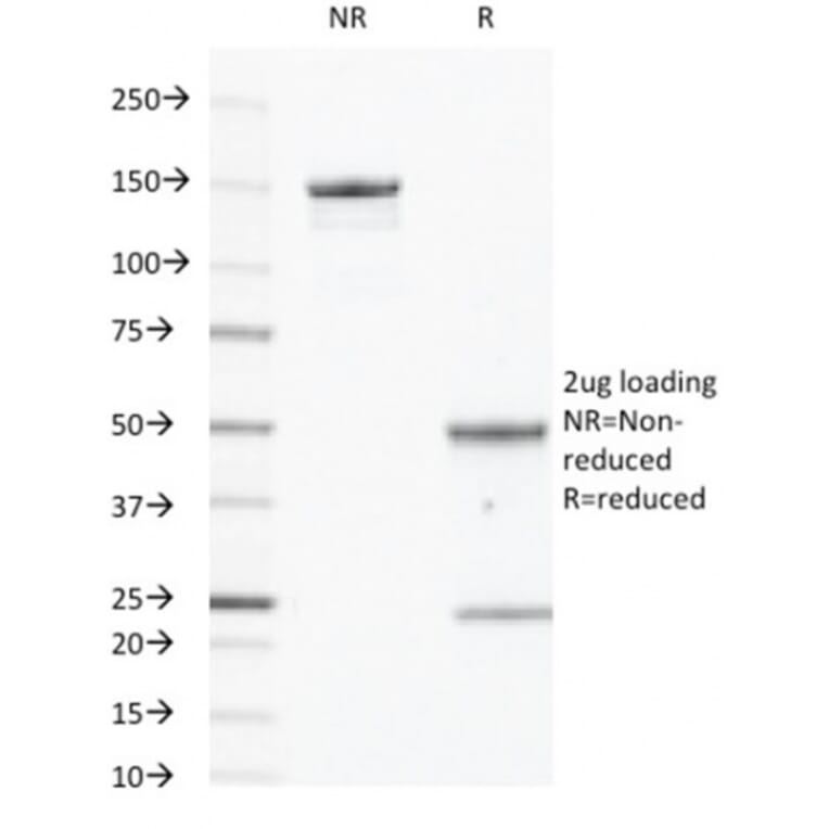 SDS-PAGE - Anti-EGFR Antibody [GFR450] (A248398) - Antibodies.com