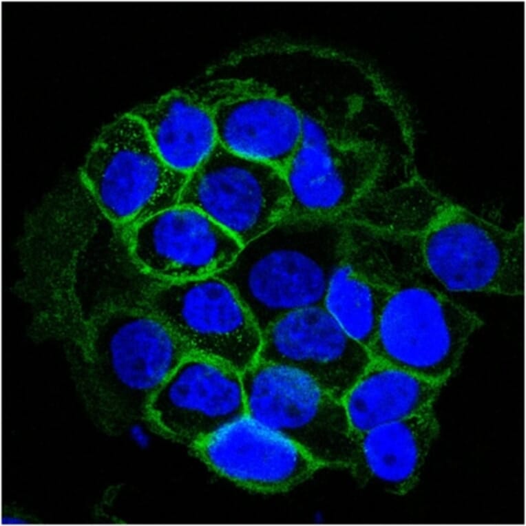 Immunofluorescence - Anti-EGFR Antibody [GFR450] (A248398) - Antibodies.com