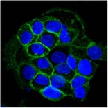 Immunofluorescence - Anti-EGFR Antibody [GFR450] (A248398) - Antibodies.com