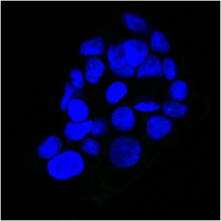 Immunofluorescence - Anti-EGFR Antibody [GFR450] (A248398) - Antibodies.com