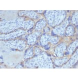 Immunohistochemistry - Anti-EGFR Antibody [rEGFR/6389] (A248399) - Antibodies.com