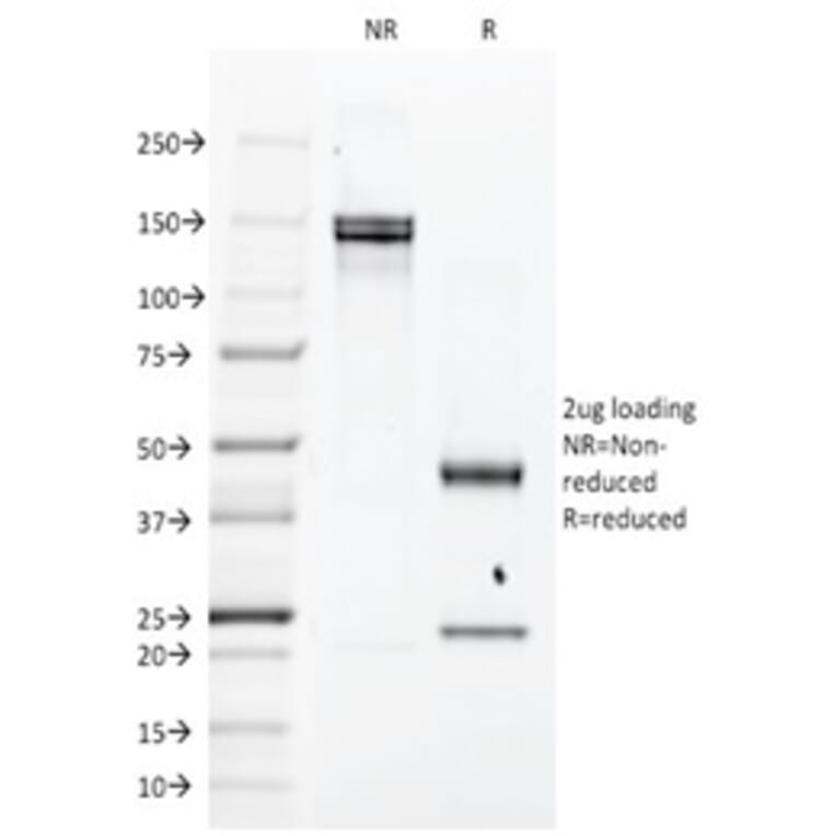 SDS-PAGE - Anti-EGFR Antibody [H9B4] (A248402) - Antibodies.com