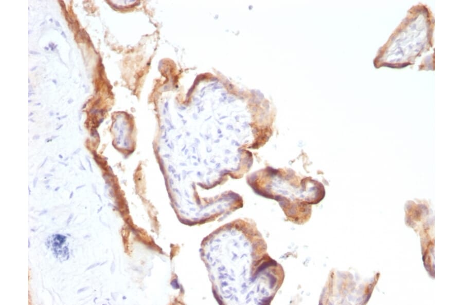 Immunohistochemistry - Anti-EGFR Antibody [SPM622] (A251576) - Antibodies.com