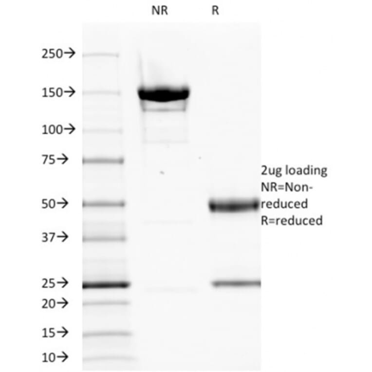 SDS-PAGE - Anti-EGFR Antibody [GFR1195] (A251592) - Antibodies.com