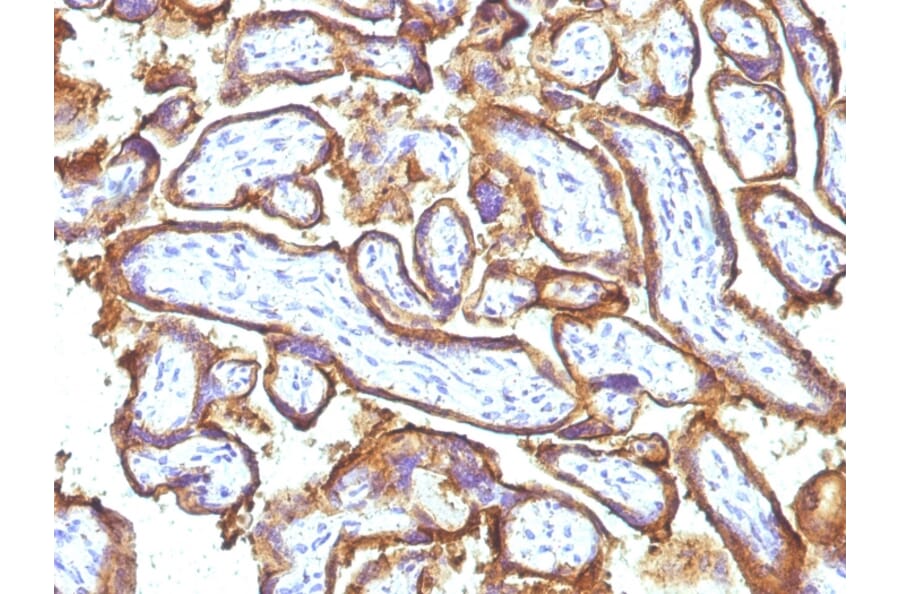 Immunohistochemistry - Anti-EGFR Antibody [31G7 + GFR1195] (A251594) - Antibodies.com