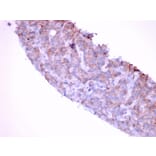 Immunohistochemistry - Anti-EGFR Antibody [GFR/1667] (A248406) - Antibodies.com