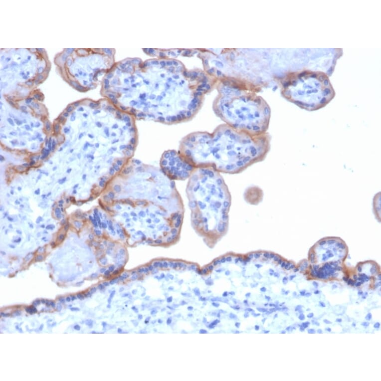 Immunohistochemistry - Anti-EGFR Antibody [GFR/1667] (A248407) - Antibodies.com