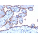 Immunohistochemistry - Anti-EGFR Antibody [GFR/1667] (A248407) - Antibodies.com