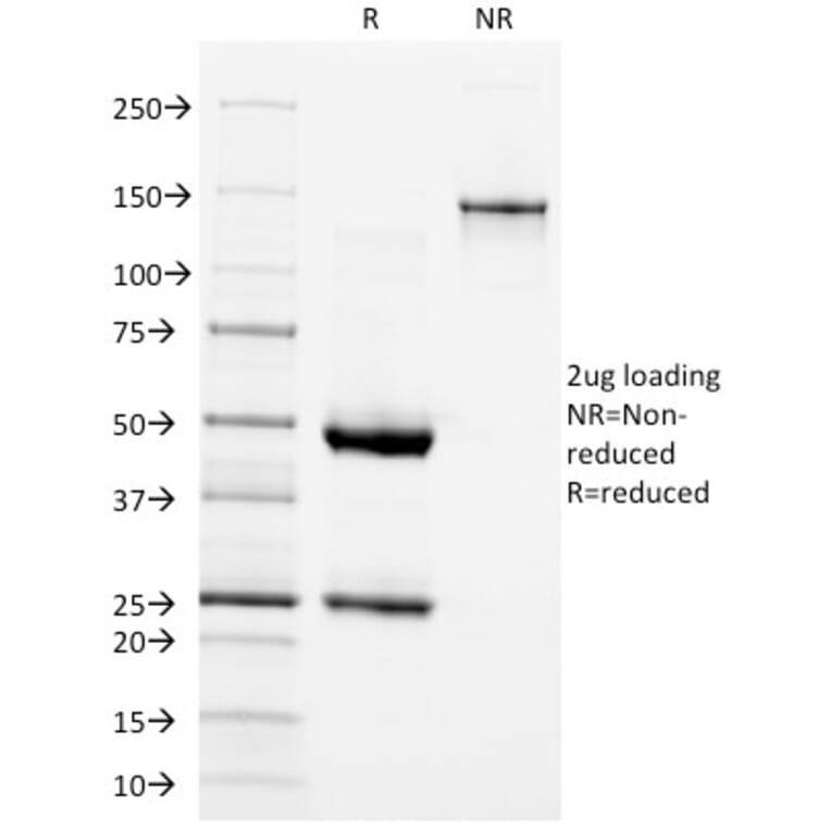 SDS-PAGE - Anti-EGFR Antibody [GFR/1667] (A248407) - Antibodies.com