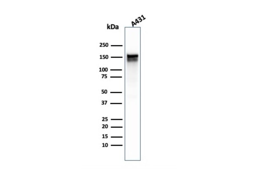 Western Blot - Anti-EGFR Antibody [GFR/1667] (A248407) - Antibodies.com