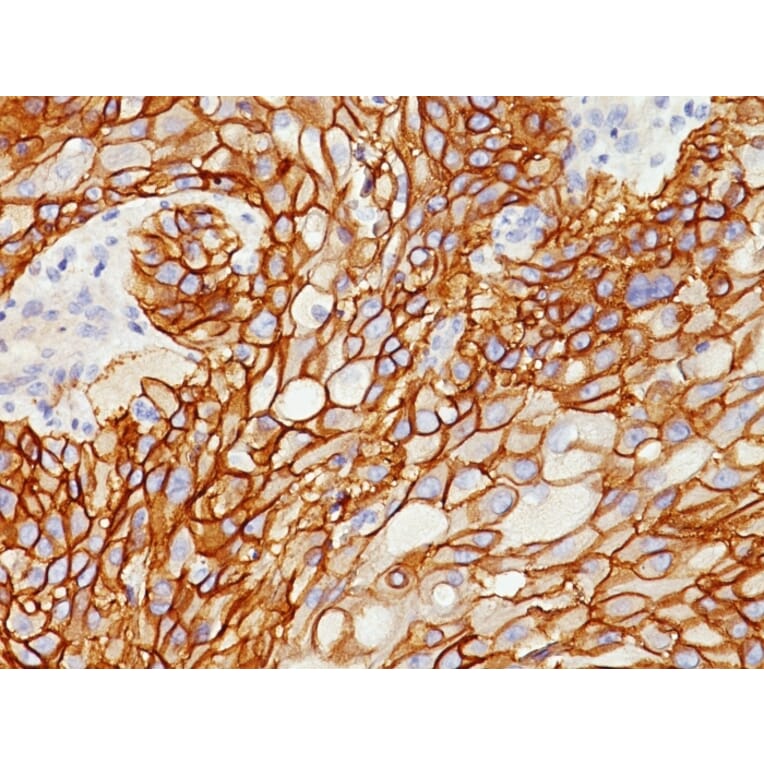 Immunohistochemistry - Anti-EGFR Antibody [GFR/1708] (A248407) - Antibodies.com