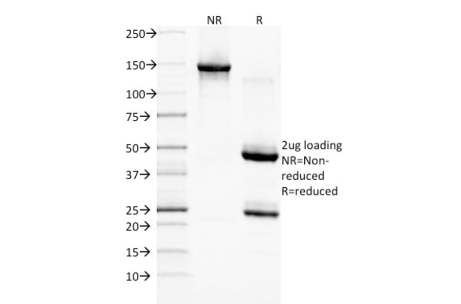 SDS-PAGE - Anti-EGFR Antibody [GFR/1708] (A248408) - Antibodies.com