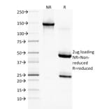SDS-PAGE - Anti-EGFR Antibody [GFR/1708] (A248408) - Antibodies.com
