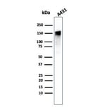 Western Blot - Anti-EGFR Antibody [GFR/1708] (A248408) - Antibodies.com