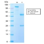 SDS-PAGE - Anti-EGFRvIII Antibody [GFR/2600R] (A248409) - Antibodies.com