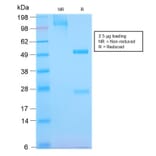 SDS-PAGE - Anti-EGFR Antibody [GFR/2968R] (A248410) - Antibodies.com