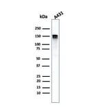 Western Blot - Anti-EGFR Antibody [GFR/2968R] (A248410) - Antibodies.com