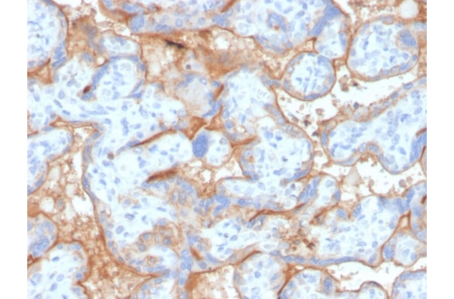 Immunohistochemistry - Anti-EGFR Antibody [GFR/4563R] (A248410) - Antibodies.com
