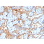 Immunohistochemistry - Anti-EGFR Antibody [GFR/4563R] (A248410) - Antibodies.com
