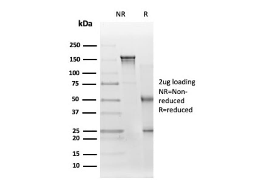 SDS-PAGE - Anti-EIF2S1 Antibody [PCRP-EIF2S1-1C11] (A248413) - Antibodies.com