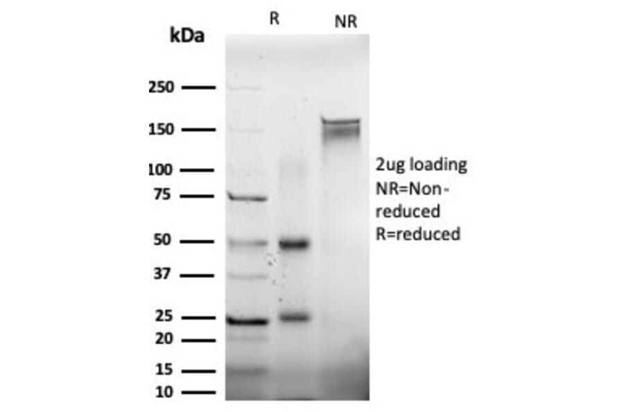 SDS-PAGE - Anti-EIF2S1 Antibody [PCRP-EIF2S1-1E2] (A248414) - Antibodies.com