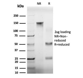 SDS-PAGE - Anti-EIF4A2 Antibody [PCRP-EIF4A2-2B5] (A248415) - Antibodies.com