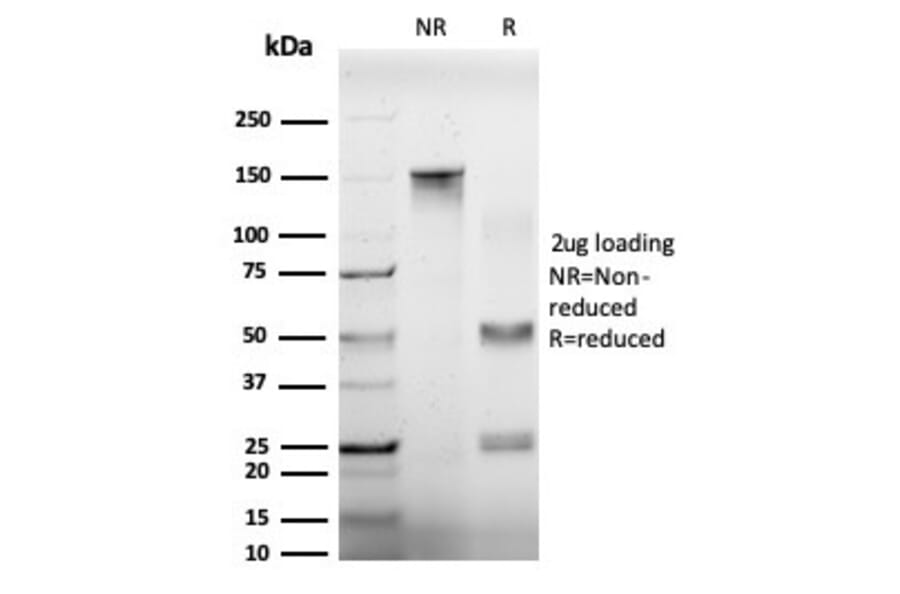 SDS-PAGE - Anti-EIF4A2 Antibody [PCRP-EIF4A2-2B5] (A248415) - Antibodies.com