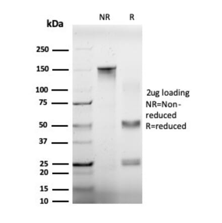 SDS-PAGE - Anti-EIF4A2 Antibody [PCRP-EIF4A2-2B5] (A248415) - Antibodies.com