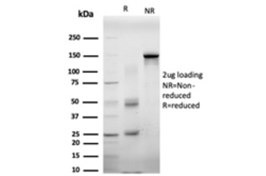 SDS-PAGE - Anti-EIF4E Antibody [PCRP-EIF4E-1D3] (A248416) - Antibodies.com