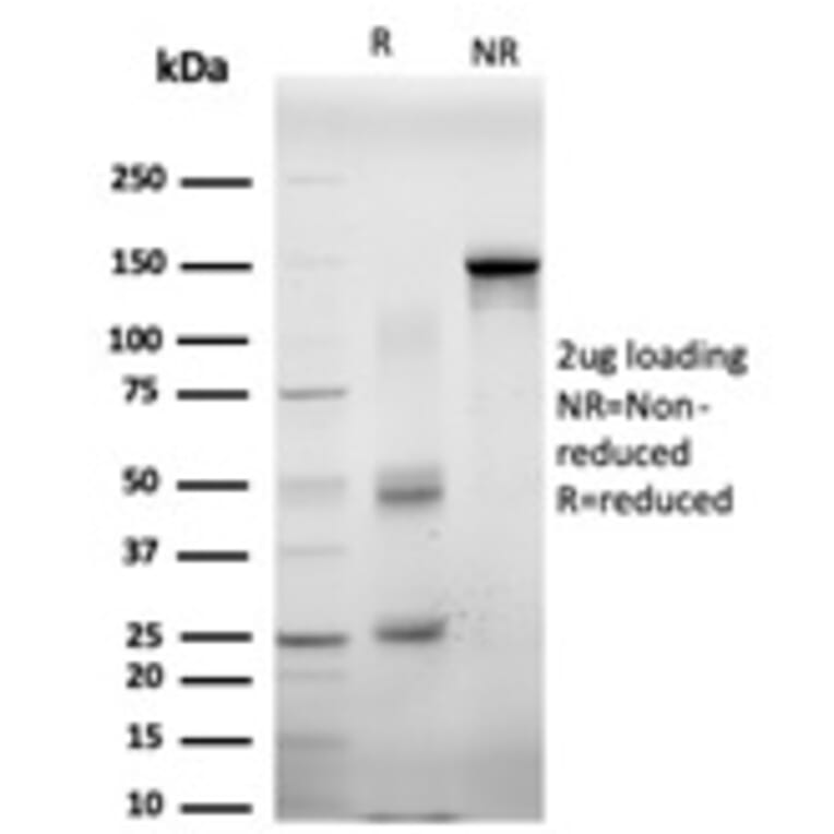 SDS-PAGE - Anti-EIF4E Antibody [PCRP-EIF4E-1D3] (A248416) - Antibodies.com