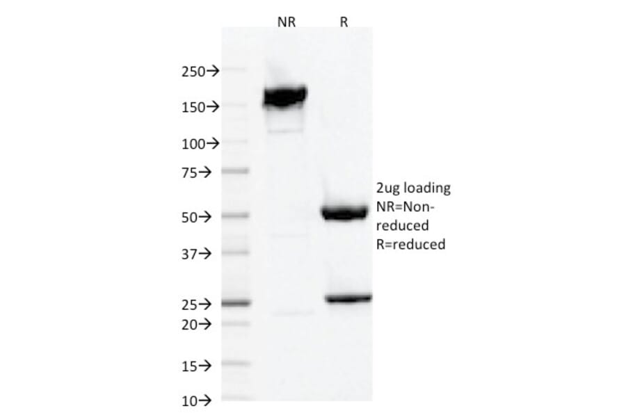 SDS-PAGE - Anti-Iba1 Antibody [AIF1/1909] (A248417) - Antibodies.com