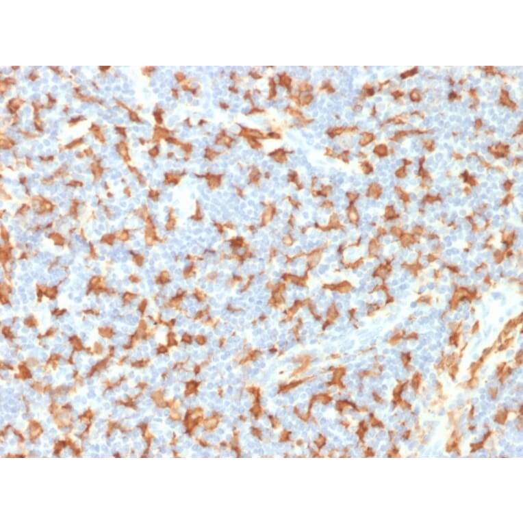 Immunohistochemistry - Anti-Iba1 Antibody [AIF1/1909] (A248417) - Antibodies.com