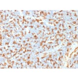 Immunohistochemistry - Anti-Iba1 Antibody [AIF1/1909] (A248417) - Antibodies.com