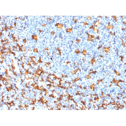 Immunohistochemistry - Anti-Iba1 Antibody [rAIF1/1909] (A248418) - Antibodies.com