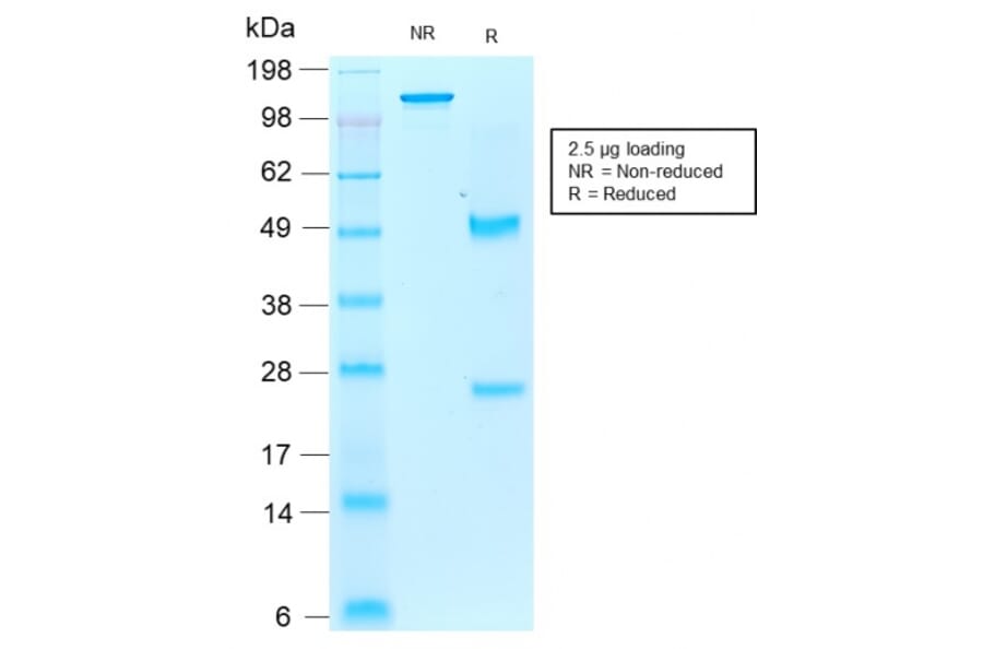 SDS-PAGE - Anti-Iba1 Antibody [rAIF1/1909] (A248418) - Antibodies.com
